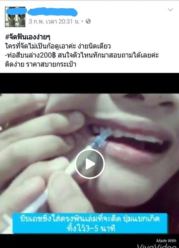 รีวิววิธีจัดฟันแบบง่าย ๆ รีวิววิธีจัดฟันแบบง่าย ๆ