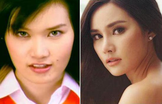 ดาราศัลยกรรม ดาราศัลยกรรม