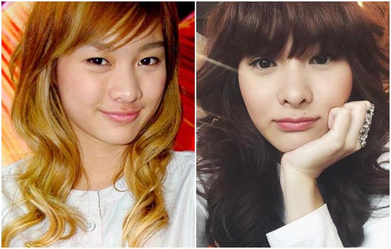 ดาราศัลยกรรม ดาราศัลยกรรม
