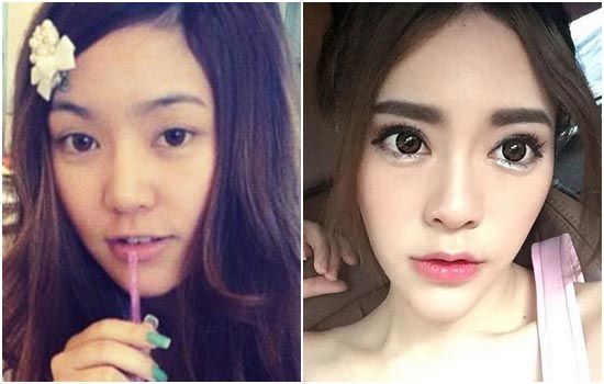 ดาราศัลยกรรม ดาราศัลยกรรม