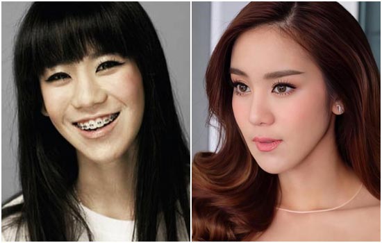 ดาราศัลยกรรม ดาราศัลยกรรม