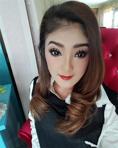 ดาว มยุรี ศัลยกรรม ดาว มยุรี ศัลยกรรม