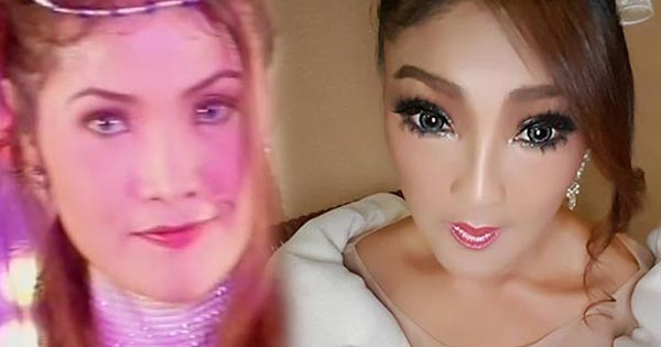 ดาว มยุรี ศัลยกรรม ดาว มยุรี ศัลยกรรม