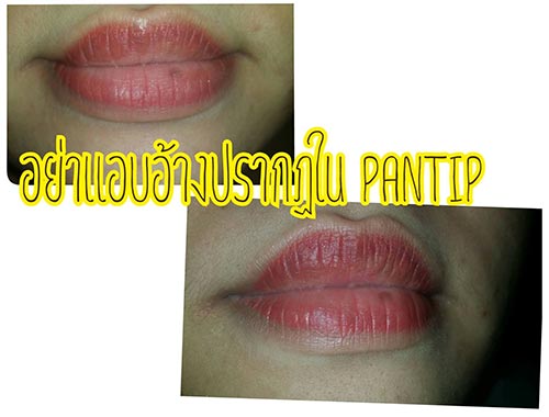 ลบรอยสักคิ้ว ลบรอยสักคิ้ว