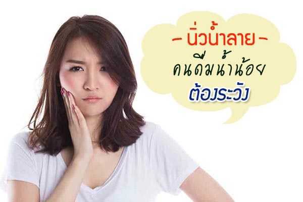นิ่วน้ำลาย นิ่วน้ำลาย