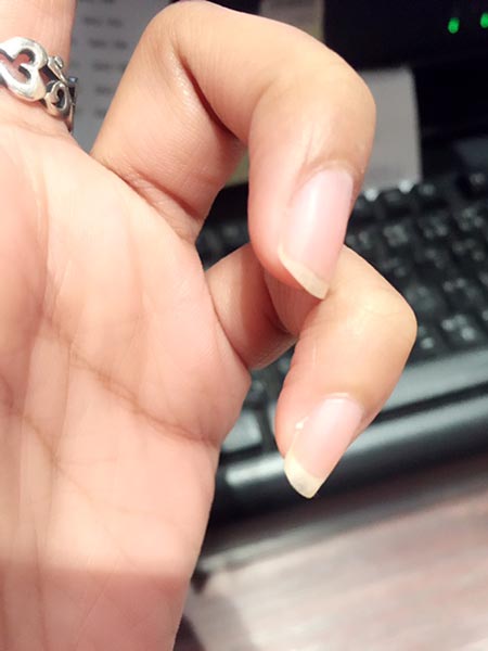 อย่าดึงจมูกเล็บ อย่าดึงจมูกเล็บ