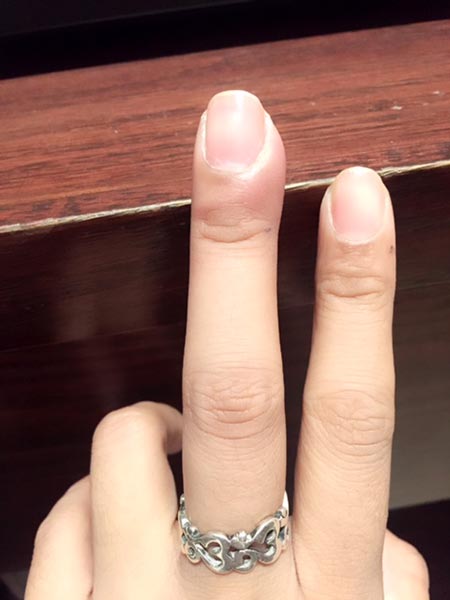 อย่าดึงจมูกเล็บ อย่าดึงจมูกเล็บ