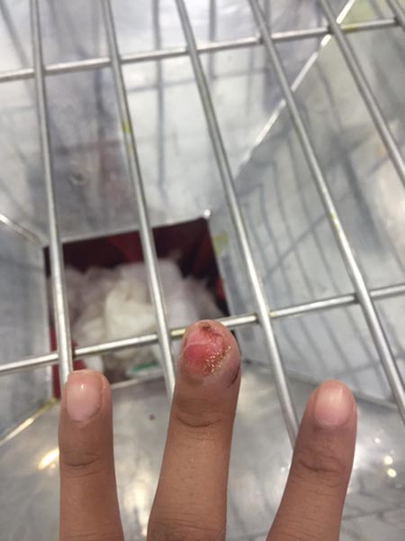 อย่าดึงจมูกเล็บ อย่าดึงจมูกเล็บ