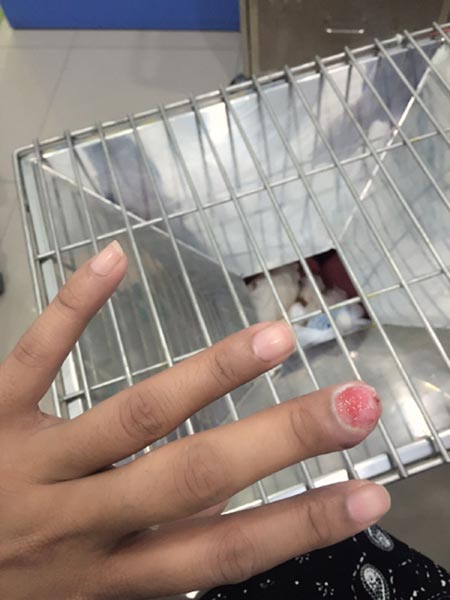 อย่าดึงจมูกเล็บ อย่าดึงจมูกเล็บ