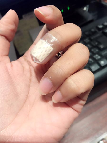อย่าดึงจมูกเล็บ อย่าดึงจมูกเล็บ