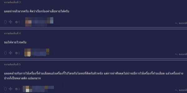 ผ่าฟันคุด ผ่าฟันคุด