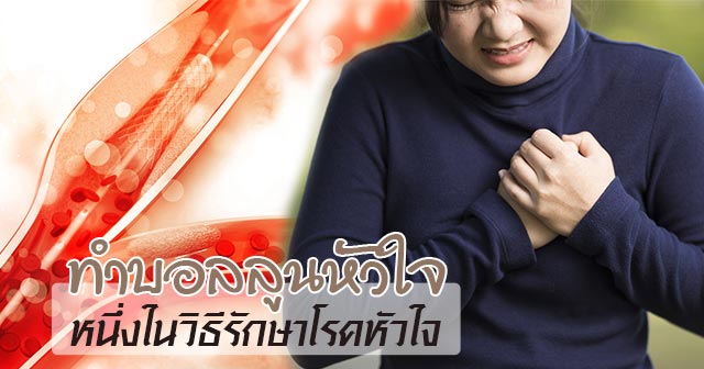 บอลลูนหัวใจ บอลลูนหัวใจ