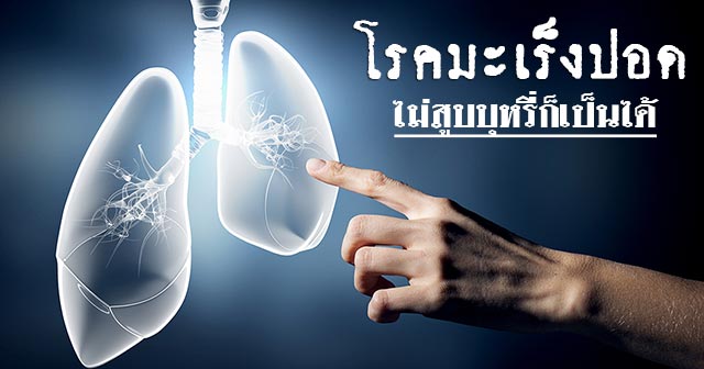 มะเร็งปอด มะเร็งปอด
