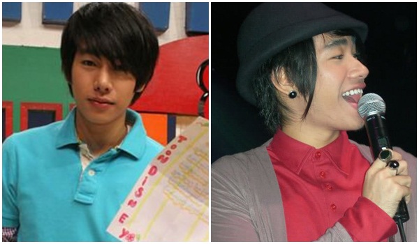 เป๊ก ผลิตโชค ศัลยกรรม เป๊ก ผลิตโชค ศัลยกรรม