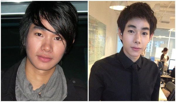 เป๊ก ผลิตโชค ศัลยกรรม เป๊ก ผลิตโชค ศัลยกรรม