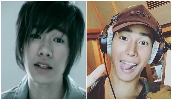 เป๊ก ผลิตโชค ศัลยกรรม เป๊ก ผลิตโชค ศัลยกรรม