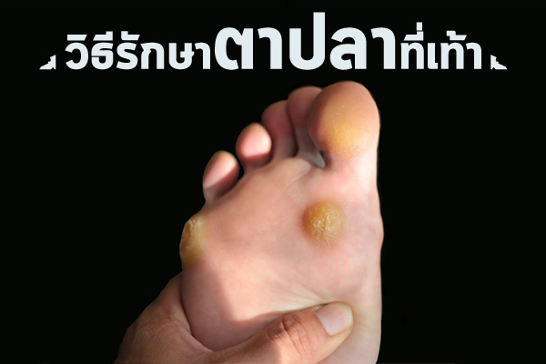 ตาปลา ตาปลา