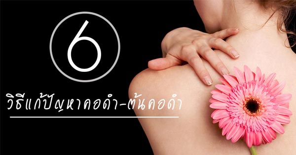 วิธีแก้คอดำ ต้นคอดำ วิธีแก้คอดำ ต้นคอดำ