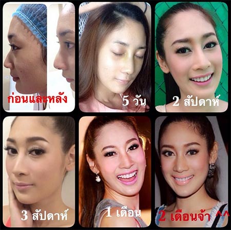 น้ำเพชร น้ำเพชร