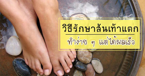 ส้นเท้าแตกทำไง ส้นเท้าแตกทำไง
