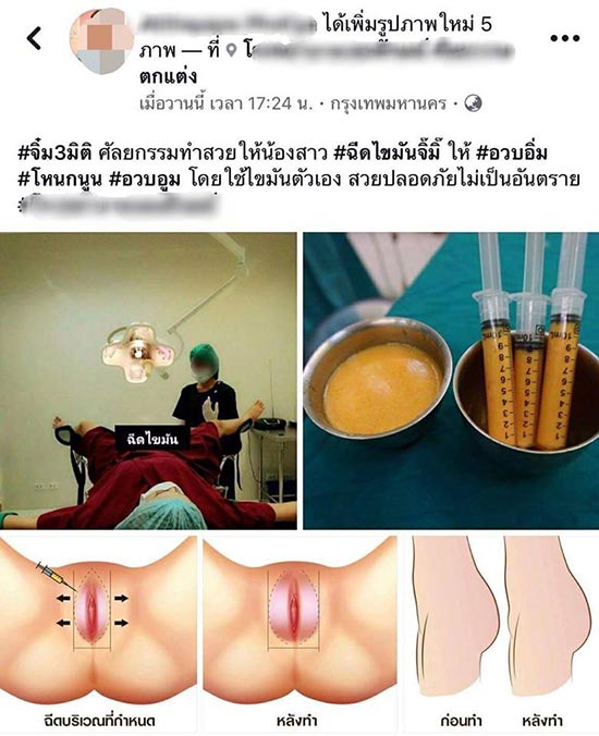 ศัลยกรรม ศัลยกรรม