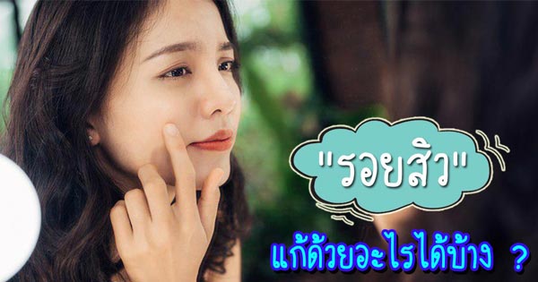 รอยสิวแก้ด้วยอะไรได้บ้าง รอยสิวแก้ด้วยอะไรได้บ้าง
