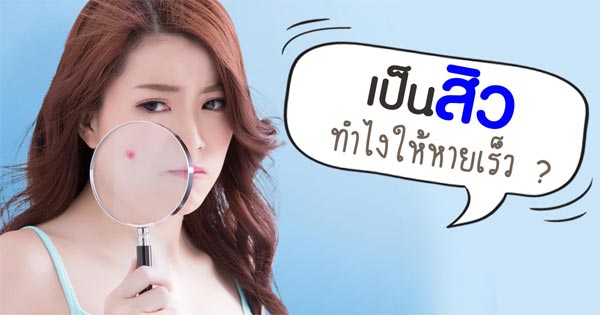 วิธีรักษาสิว วิธีรักษาสิว