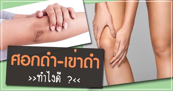 วิธีแก้ข้อศอกดํา เข่าดํา วิธีแก้ข้อศอกดํา เข่าดํา
