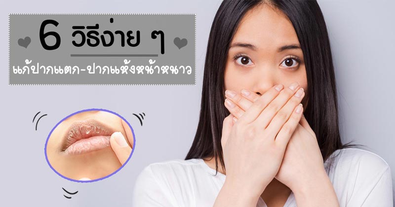 วิธีแก้ปากแตก หน้าหนาว วิธีแก้ปากแตก หน้าหนาว