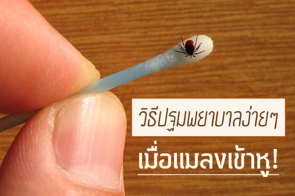 แมลงเข้าหู แมลงเข้าหู