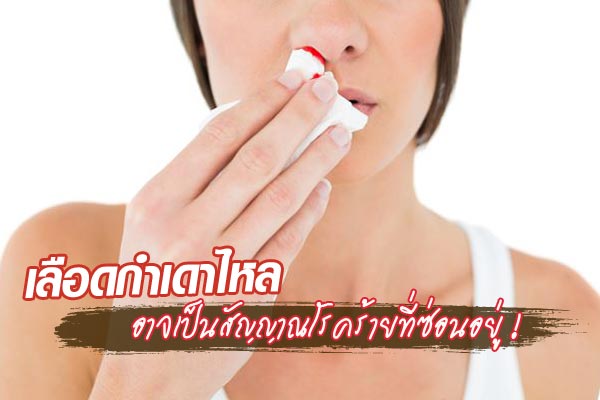 เลือดกำเดาไหล เลือดกำเดาไหล