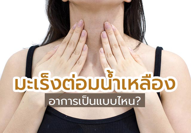 มะเร็งต่อมน้ำเหลือง มะเร็งต่อมน้ำเหลือง