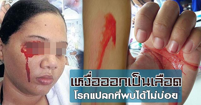 เหงื่อเป็นเลือด เหงื่อเป็นเลือด