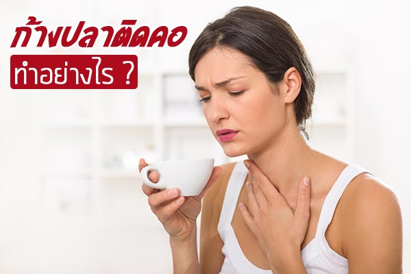 ก้างปลาติดคอ ก้างปลาติดคอ