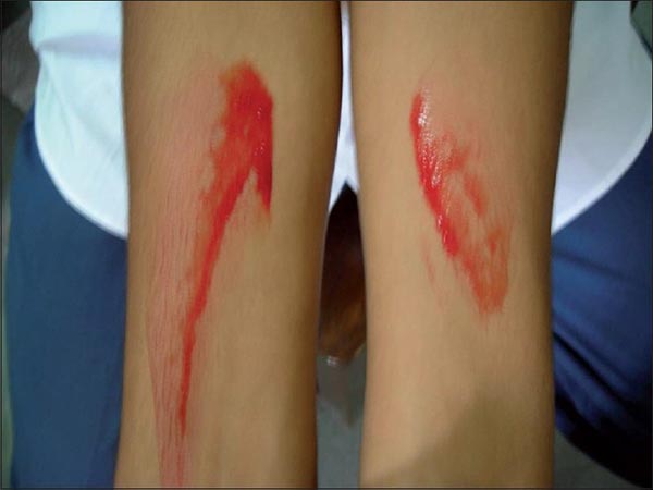 เหงื่อเป็นเลือด เหงื่อเป็นเลือด