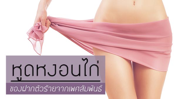 หูดหงอนไก่ หูดหงอนไก่