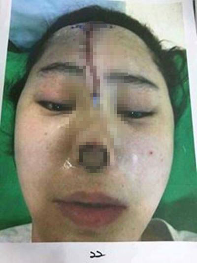 พิษศัลยกรรม พิษศัลยกรรม