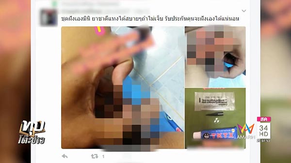 การฝังมุก การฝังมุก