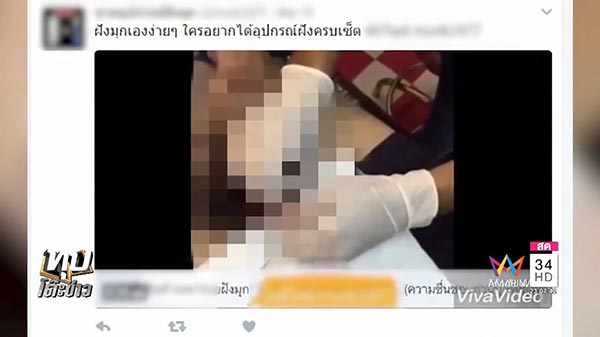 การฝังมุก การฝังมุก