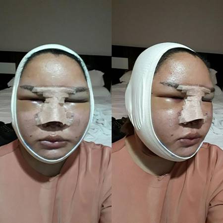 ทำศัลยกรรม ทำศัลยกรรม
