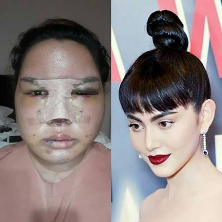 ทำศัลยกรรม ทำศัลยกรรม