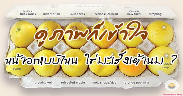 มะเร็งเต้านม มะเร็งเต้านม