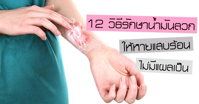 วิธีรักษา นํ้ามันลวกแขน วิธีรักษา นํ้ามันลวกแขน
