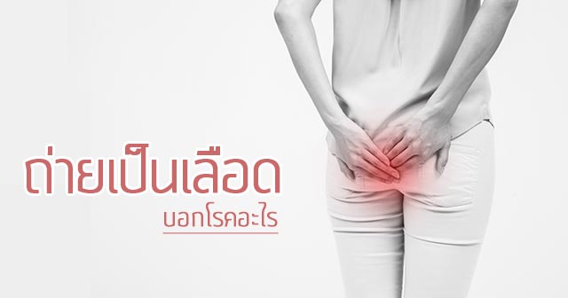 อุจจาระบอกโรค อุจจาระบอกโรค