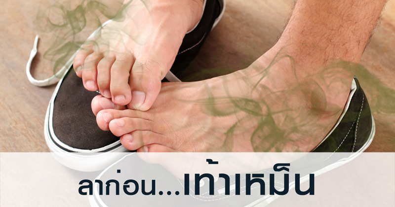 วิธีแก้เท้าเหม็น วิธีแก้เท้าเหม็น