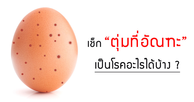 ตุ่มที่อัณฑะ ตุ่มที่อัณฑะ