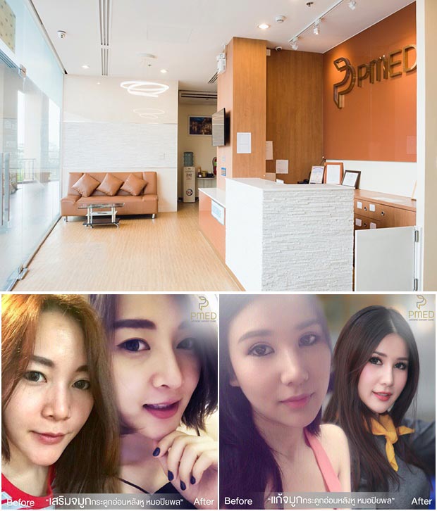 ทำจมูกที่ไหนดี ทำจมูกที่ไหนดี