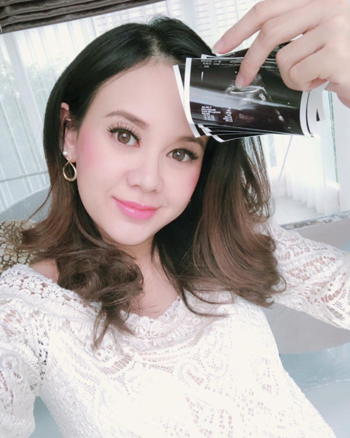 แยม ธมลพรรณ์ คลอดลูก แยม ธมลพรรณ์ คลอดลูก