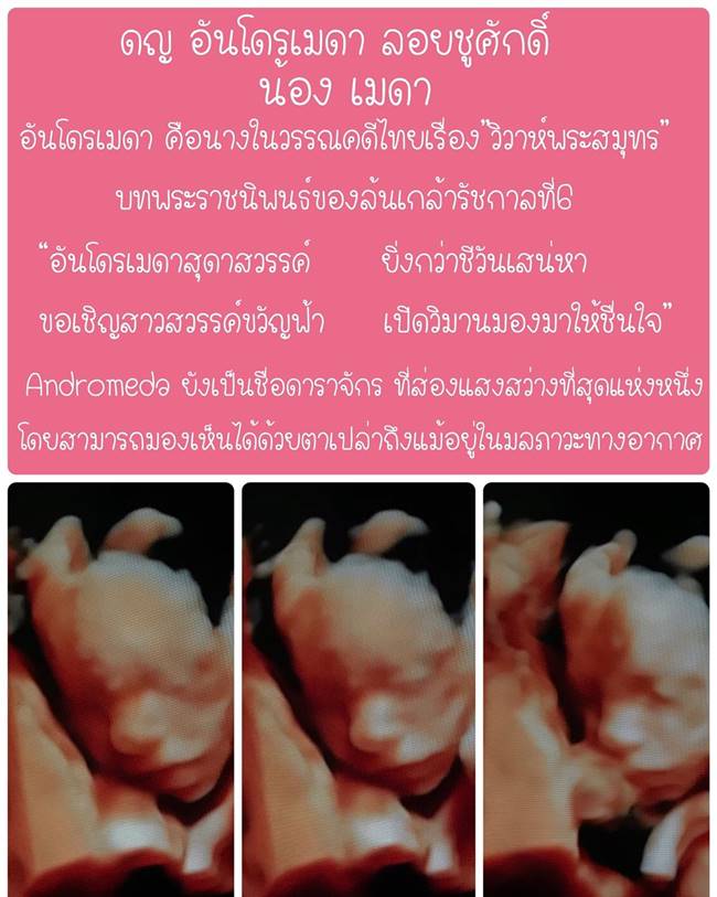 เจมส์ เรืองศักดิ์ เจมส์ เรืองศักดิ์