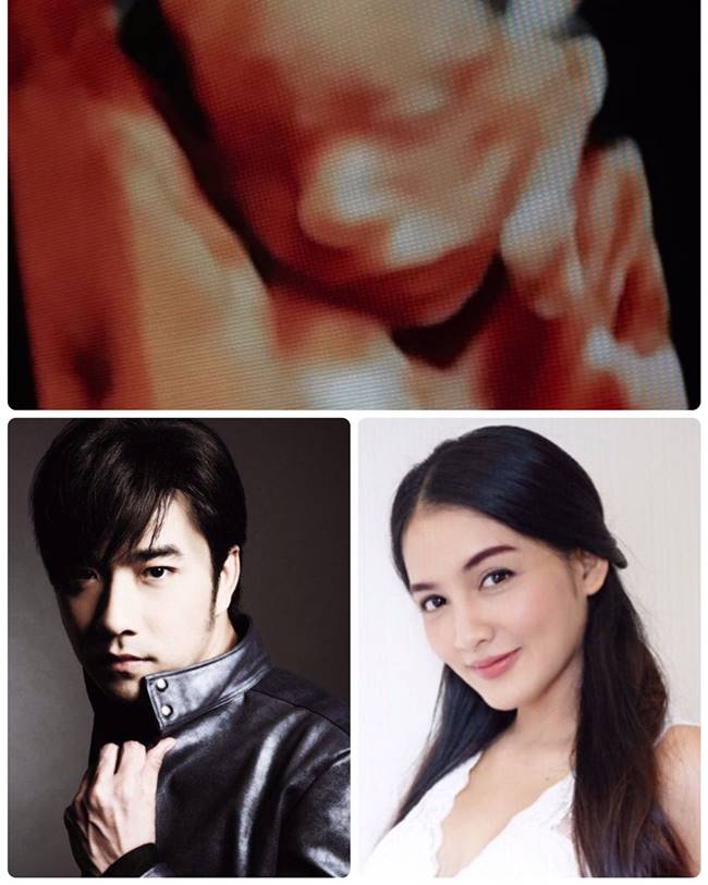เจมส์ เรืองศักดิ์ เจมส์ เรืองศักดิ์